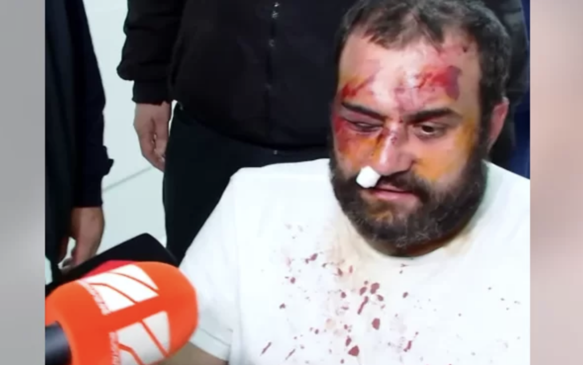 Attacks on Opposition Politicians and Activists in Georgia