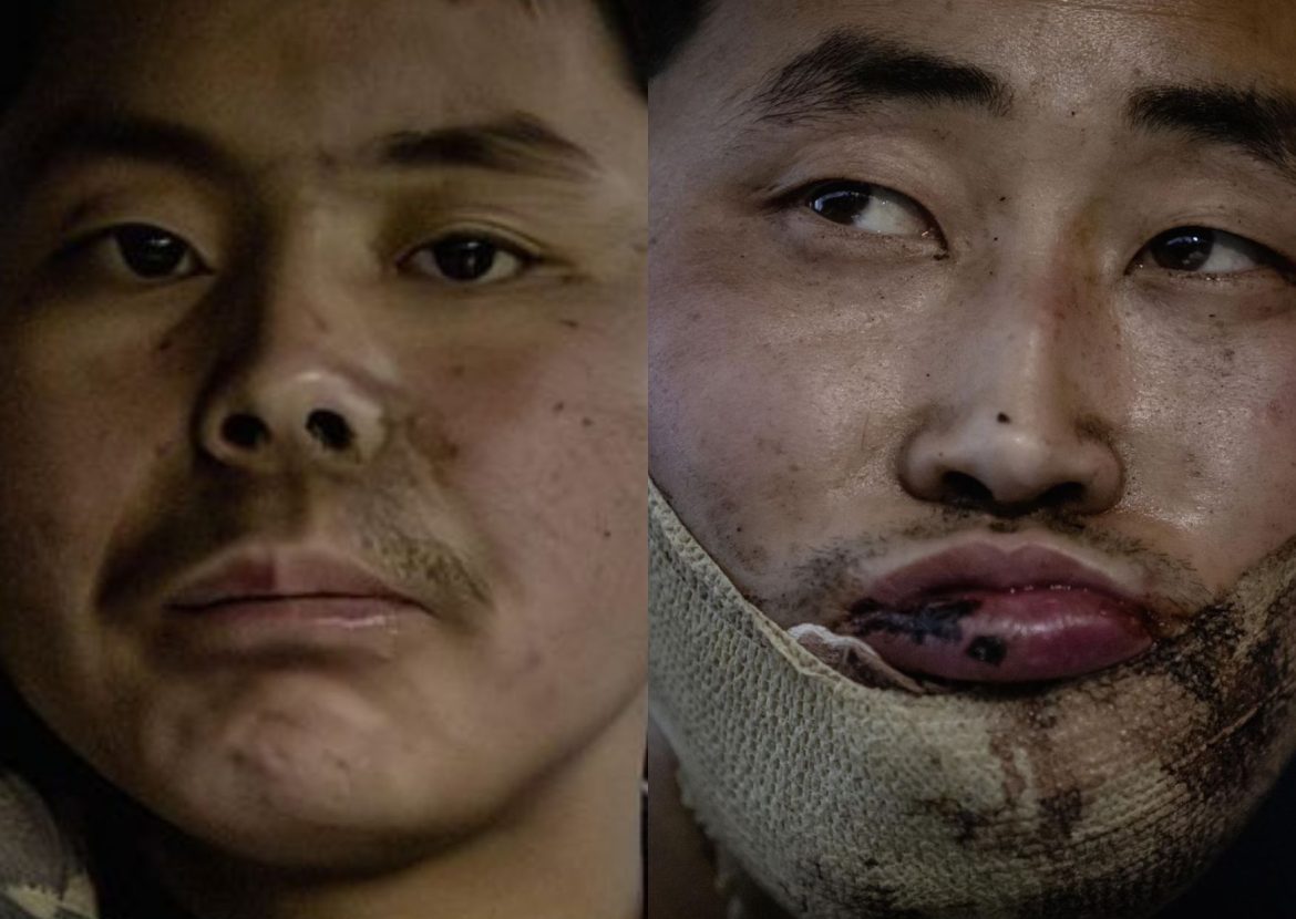 First Capture of North Korean Soldiers Fighting for Russia Reported in Kyiv