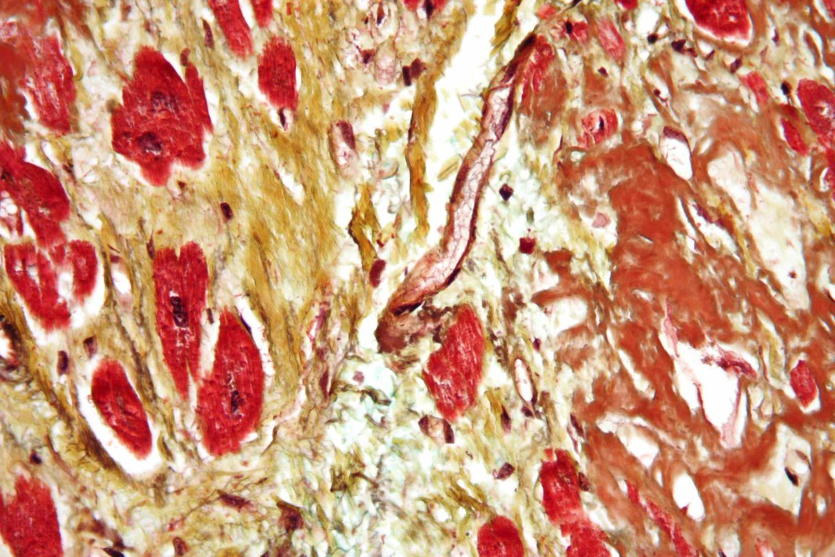 Cardiovascular