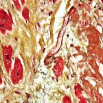 Cardiovascular